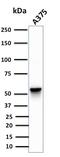 Vimentin antibody, GTX35161, GeneTex, Western Blot image 
