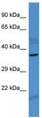 Zinc Finger Protein 793 antibody, TA345175, Origene, Western Blot image 