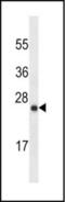 LY6/PLAUR Domain Containing 6B antibody, orb375391, Biorbyt, Western Blot image 