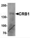 Crumbs homolog 1 antibody, 7153, ProSci Inc, Western Blot image 
