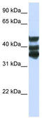 Homogentisate 1,2-Dioxygenase antibody, TA339212, Origene, Western Blot image 
