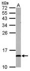 NADH:Ubiquinone Oxidoreductase Subunit A5 antibody, TA308306, Origene, Western Blot image 