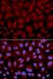 Butyrylcholinesterase antibody, LS-C331478, Lifespan Biosciences, Immunofluorescence image 