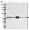 Coiled-Coil Domain Containing 117 antibody, NBP1-81977, Novus Biologicals, Western Blot image 