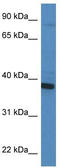 Cytochrome B5 Reductase 3 antibody, TA343075, Origene, Western Blot image 