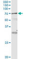 VPS18 Core Subunit Of CORVET And HOPS Complexes antibody, LS-C139435, Lifespan Biosciences, Immunoprecipitation image 