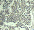 c-Kit antibody, AP0286, ABclonal Technology, Immunohistochemistry paraffin image 