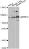 Zinc Finger And BTB Domain Containing 16 antibody, A5863, ABclonal Technology, Western Blot image 
