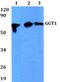 Gamma-glutamyltranspeptidase 1 antibody, A02340, Boster Biological Technology, Western Blot image 