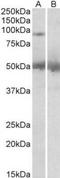 Ubiquitin Specific Peptidase 6 antibody, TA311302, Origene, Western Blot image 
