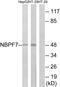 NBPF Member 7 antibody, PA5-39295, Invitrogen Antibodies, Western Blot image 