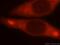 CTP Synthase 1 antibody, 15914-1-AP, Proteintech Group, Immunofluorescence image 