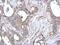 S100 Calcium Binding Protein A10 antibody, PA5-27251, Invitrogen Antibodies, Immunohistochemistry frozen image 