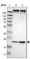 Mannose-P-Dolichol Utilization Defect 1 antibody, NBP1-84570, Novus Biologicals, Western Blot image 