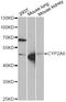 Cytochrome P450 Family 2 Subfamily A Member 6 antibody, STJ28378, St John