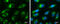 Ribosome Binding Protein 1 antibody, GTX628997, GeneTex, Immunofluorescence image 