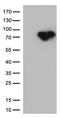 Methylenetetrahydrofolate Reductase antibody, CF812671, Origene, Western Blot image 