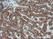 Ubiquitin Conjugating Enzyme E2 E3 antibody, LS-C175118, Lifespan Biosciences, Immunohistochemistry paraffin image 