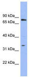 POZ-, AT hook-, and zinc finger-containing protein 1 antibody, TA330579, Origene, Western Blot image 