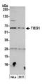 KLF10 antibody, A302-015A, Bethyl Labs, Western Blot image 