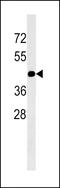 Gap Junction Protein Gamma 2 antibody, LS-C166487, Lifespan Biosciences, Western Blot image 