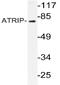 ATR Interacting Protein antibody, AP20204PU-N, Origene, Western Blot image 