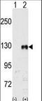 EPHB1 antibody, LS-C100281, Lifespan Biosciences, Western Blot image 