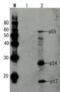 HIV1 gp41 antibody, 65-014, BioAcademia Inc, Western Blot image 