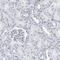 Solute Carrier Organic Anion Transporter Family Member 1B3 antibody, HPA004943, Atlas Antibodies, Immunohistochemistry frozen image 