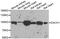 Dachshund Family Transcription Factor 1 antibody, PA5-77057, Invitrogen Antibodies, Western Blot image 