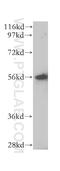 Leucine Aminopeptidase 3 antibody, 14612-1-AP, Proteintech Group, Western Blot image 