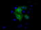 26S protease regulatory subunit 6A antibody, TA500926, Origene, Immunofluorescence image 