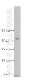 Ribonuclease P/MRP Subunit P40 antibody, 11736-1-AP, Proteintech Group, Western Blot image 