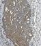 UL16 Binding Protein 1 antibody, A04323-1, Boster Biological Technology, Immunohistochemistry paraffin image 
