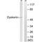 Dyskerin Pseudouridine Synthase 1 antibody, PA5-49770, Invitrogen Antibodies, Western Blot image 