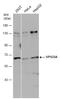 VPS33A Core Subunit Of CORVET And HOPS Complexes antibody, GTX119416, GeneTex, Western Blot image 