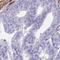 Zinc Finger Protein 418 antibody, HPA043800, Atlas Antibodies, Immunohistochemistry paraffin image 