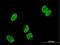 TP53 Regulating Kinase antibody, H00112858-M06, Novus Biologicals, Immunocytochemistry image 