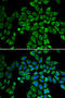 Angiopoietin 2 antibody, STJ22609, St John
