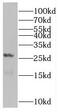 Ras-related protein Rab-5B antibody, FNab07040, FineTest, Western Blot image 