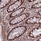 Calcineurin Binding Protein 1 antibody, HPA043296, Atlas Antibodies, Immunohistochemistry paraffin image 