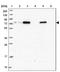 Zinc Finger Protein 417 antibody, NBP2-46668, Novus Biologicals, Western Blot image 