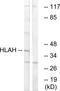 Putative HLA class I histocompatibility antigen, alpha chain H antibody, PA5-39208, Invitrogen Antibodies, Western Blot image 