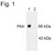 Serine/threonine-protein kinase PAK 1 antibody, PA1-4636, Invitrogen Antibodies, Western Blot image 