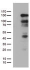 Progesterone Receptor antibody, TA802710AM, Origene, Western Blot image 