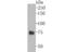 Tyrosinase Related Protein 1 antibody, A01959, Boster Biological Technology, Western Blot image 