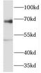 Receptor-interacting serine/threonine-protein kinase 2 antibody, FNab07314, FineTest, Western Blot image 