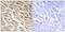 Mitochondrial Ribosomal Protein L39 antibody, LS-C120092, Lifespan Biosciences, Immunohistochemistry paraffin image 