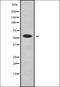 Abhydrolase Domain Containing 3 antibody, orb337939, Biorbyt, Western Blot image 