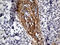 Podoplanin antibody, LS-C800024, Lifespan Biosciences, Immunohistochemistry paraffin image 